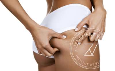 Comprendre la cellulite pour mieux la traiter !