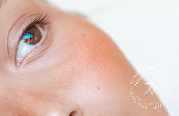 L’ACIDE HYALURONIQUE : une efficacité incontestable sur la peau